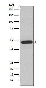 Anti-NCF1 Rabbit Monoclonal Antibody Boster Bio