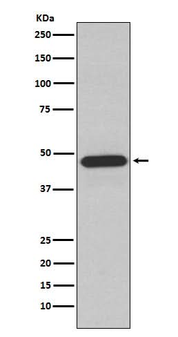 Anti-NCF1 Rabbit Monoclonal Antibody Boster Bio