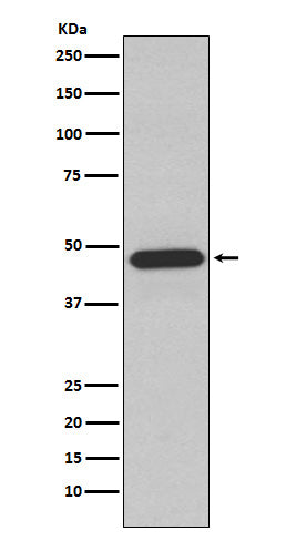 Anti-NCF1 Rabbit Monoclonal Antibody Boster Bio