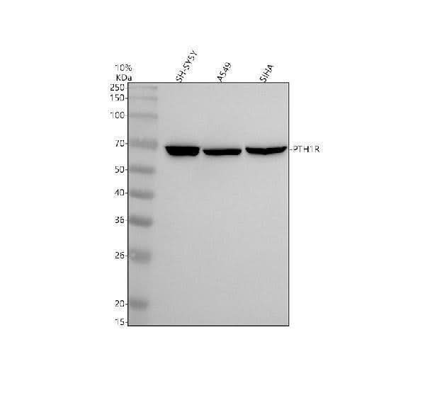 Anti-Parathyroid Hormone Receptor 1 Monoclonal Antibody Boster Bio