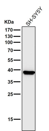 Anti-Cathepsin L/V/K/H Rabbit Monoclonal Antibody Boster Bio