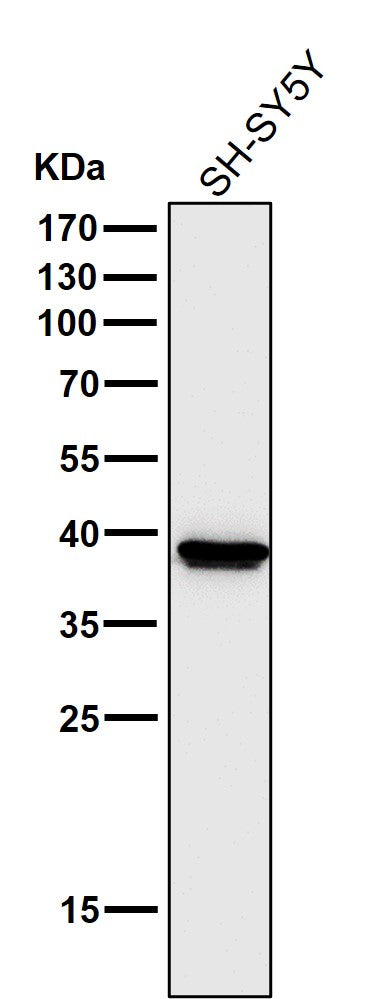 Anti-Cathepsin L/V/K/H Rabbit Monoclonal Antibody Boster Bio