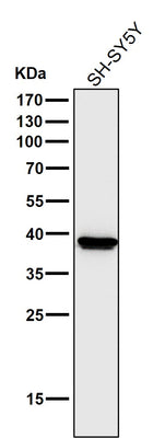 Anti-Cathepsin L/V/K/H Rabbit Monoclonal Antibody Boster Bio