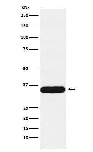 Anti-Tropomyosin 1 Rabbit Monoclonal Antibody Boster Bio