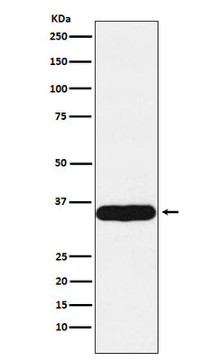 Anti-Tropomyosin 1 Rabbit Monoclonal Antibody Boster Bio