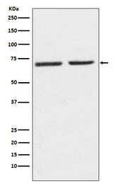 Anti-5HT2C Receptor Rabbit Monoclonal Antibody Boster Bio