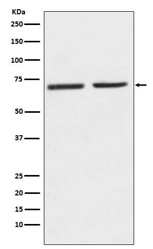 Anti-5HT2C Receptor Rabbit Monoclonal Antibody Boster Bio
