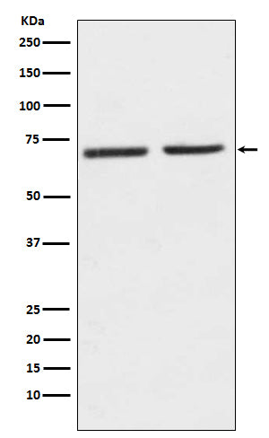 Anti-5HT2C Receptor Rabbit Monoclonal Antibody Boster Bio
