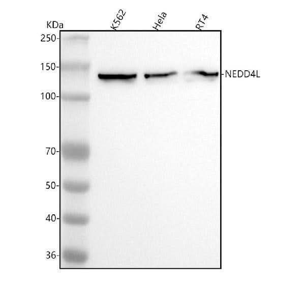 Anti-NEDD4-2 NEDD4L Rabbit Monoclonal Antibody Boster Bio