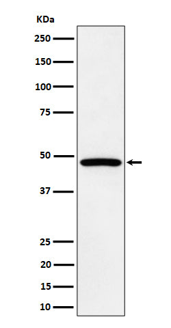 Anti-PTPN2 Rabbit Monoclonal Antibody Boster Bio