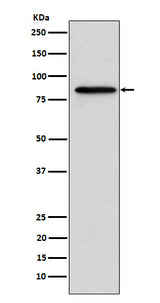 Anti-Gelsolin GSN Rabbit Monoclonal Antibody Boster Bio