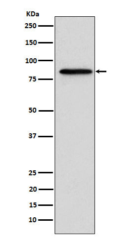 Anti-Gelsolin GSN Rabbit Monoclonal Antibody Boster Bio