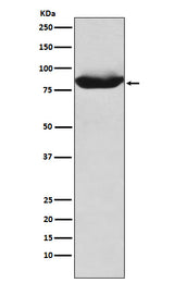 Anti-MALT1 Rabbit Monoclonal Antibody Boster Bio