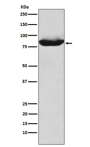 Anti-MALT1 Rabbit Monoclonal Antibody Boster Bio