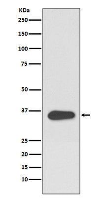 Anti-ATF1 Rabbit Monoclonal Antibody Boster Bio