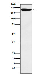 Anti-IQGAP1 Monoclonal Antibody Boster Bio