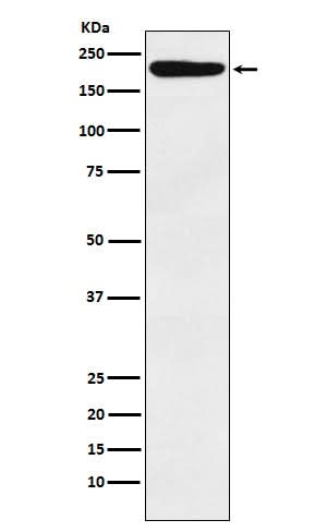 Anti-IQGAP1 Monoclonal Antibody Boster Bio