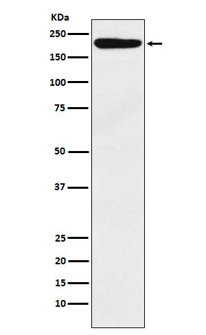 Anti-IQGAP1 Monoclonal Antibody Boster Bio