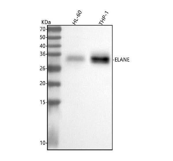 Anti-Neutrophil Elastase ELANE Rabbit Monoclonal Antibody Boster Bio