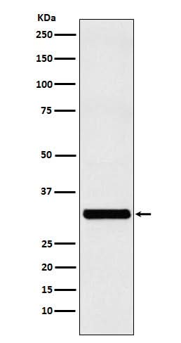 Anti-RAB27A Rabbit Monoclonal Antibody Boster Bio