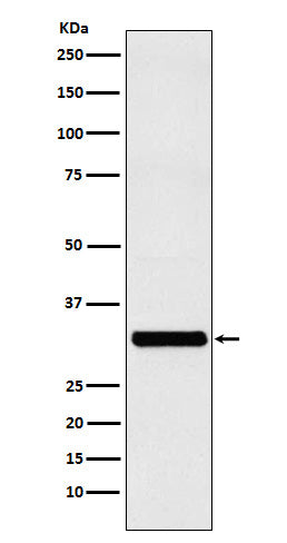 Anti-RAB27A Rabbit Monoclonal Antibody Boster Bio
