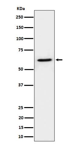 Anti-IKZF3 Rabbit Monoclonal Antibody Boster Bio