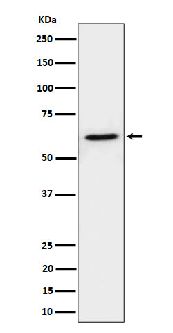 Anti-IKZF3 Rabbit Monoclonal Antibody Boster Bio