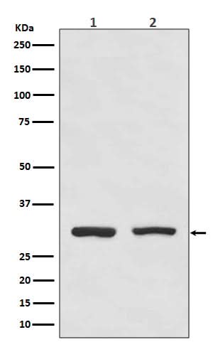 Anti-Bcl10 Rabbit Monoclonal Antibody Boster Bio