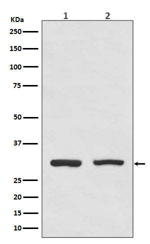 Anti-Bcl10 Rabbit Monoclonal Antibody Boster Bio