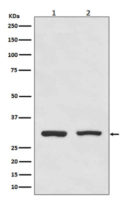 Anti-Bcl10 Rabbit Monoclonal Antibody Boster Bio