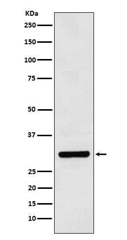 Anti-Bcl10 Rabbit Monoclonal Antibody Boster Bio