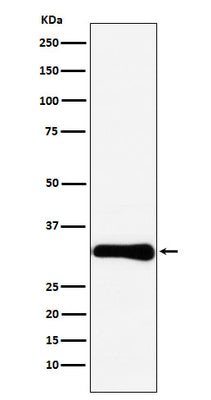 Anti-Bcl10 Rabbit Monoclonal Antibody Boster Bio