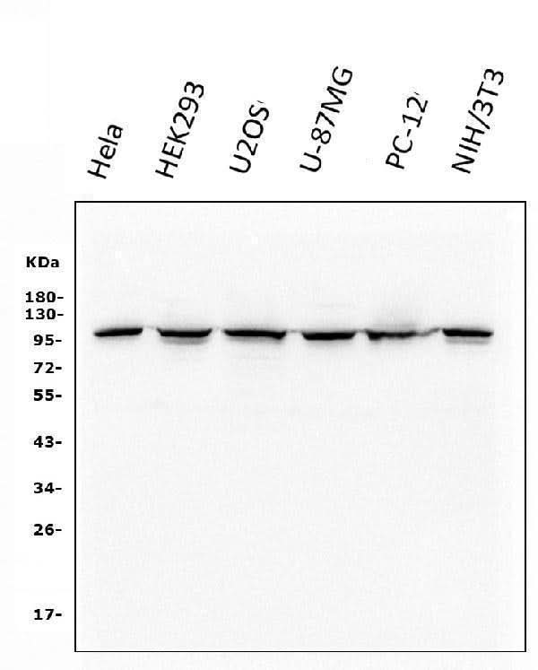 Anti-alpha 1 Catenin/CTNNA1 Antibody Picoband® (monoclonal, 10I2 Boster Bio