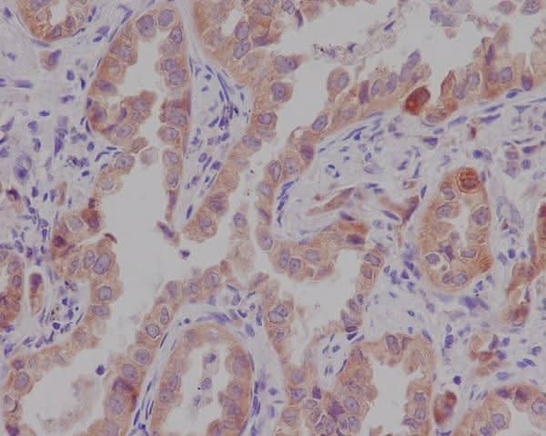 Anti-Catenin alpha 1 CTNNA1 Rabbit Monoclonal Antibody Boster Bio
