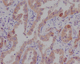 Anti-Catenin alpha 1 CTNNA1 Rabbit Monoclonal Antibody Boster Bio