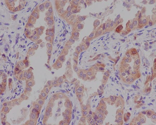 Anti-Catenin alpha 1 CTNNA1 Rabbit Monoclonal Antibody Boster Bio