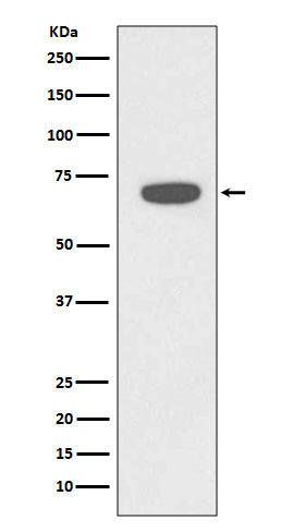 Anti-Rad18 Rabbit Monoclonal Antibody Boster Bio
