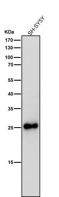 Anti-SNAP25 Rabbit Monoclonal Antibody Boster Bio