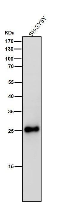 Anti-SNAP25 Rabbit Monoclonal Antibody Boster Bio