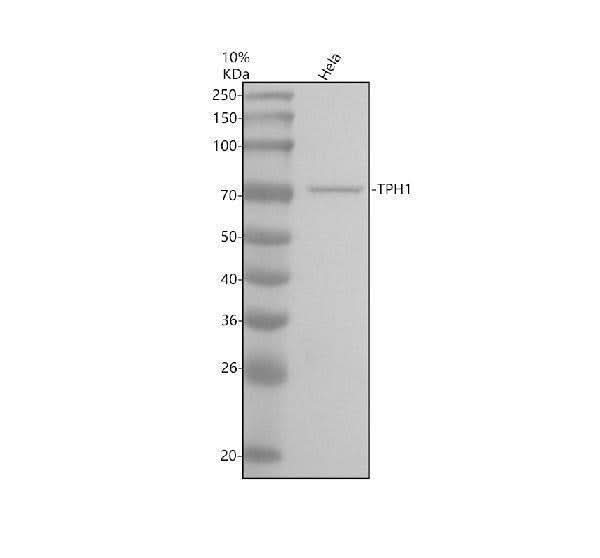 Anti-TPH1/Tph Rabbit Monoclonal Antibody Boster Bio