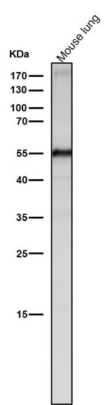 Anti-Slit2 Monoclonal Antibody Boster Bio