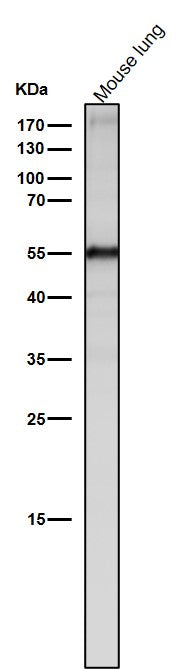 Anti-Slit2 Monoclonal Antibody Boster Bio