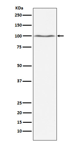 Anti-Dynamin 2 Monoclonal Antibody Boster Bio