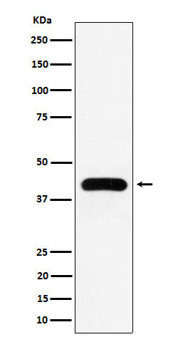 Anti-MVD Rabbit Monoclonal Antibody Boster Bio
