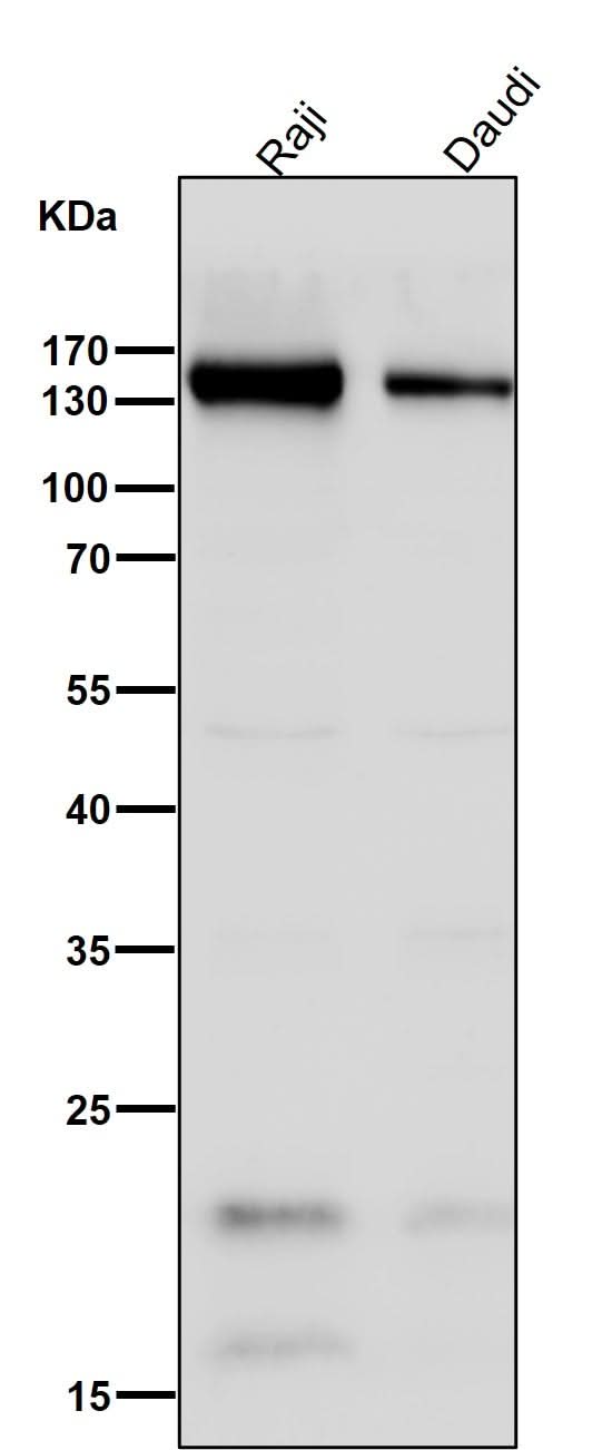 Anti-CD21 CR2 Rabbit Monoclonal Antibody Boster Bio