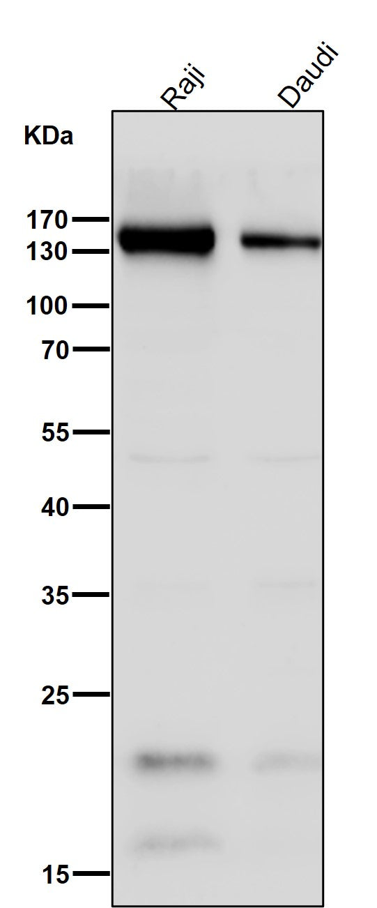 Anti-CD21 CR2 Rabbit Monoclonal Antibody Boster Bio