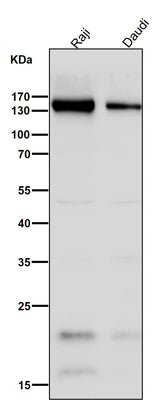 Anti-CD21 CR2 Rabbit Monoclonal Antibody Boster Bio
