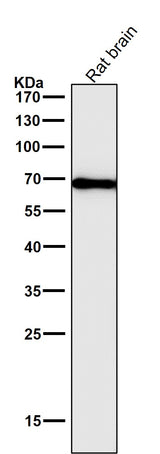 Anti-Cytokeratin 1 Rabbit Monoclonal Antibody Boster Bio