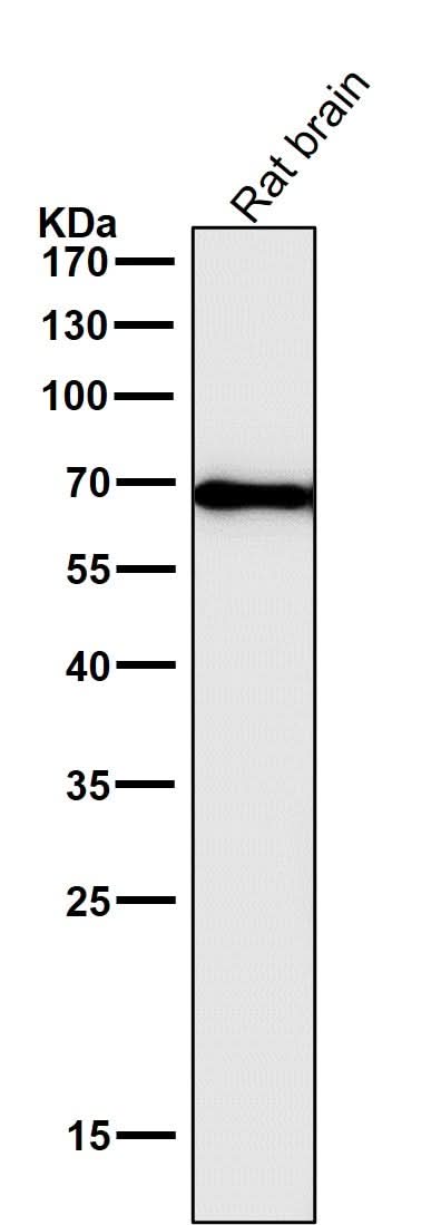Anti-Cytokeratin 1 Rabbit Monoclonal Antibody Boster Bio