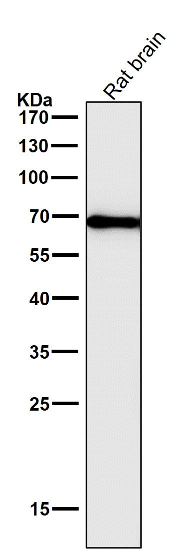 Anti-Cytokeratin 1 Rabbit Monoclonal Antibody Boster Bio